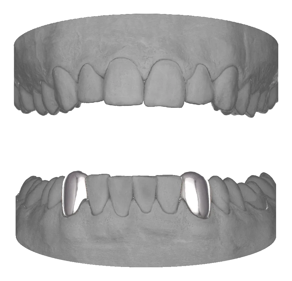 Canine Canine Lower