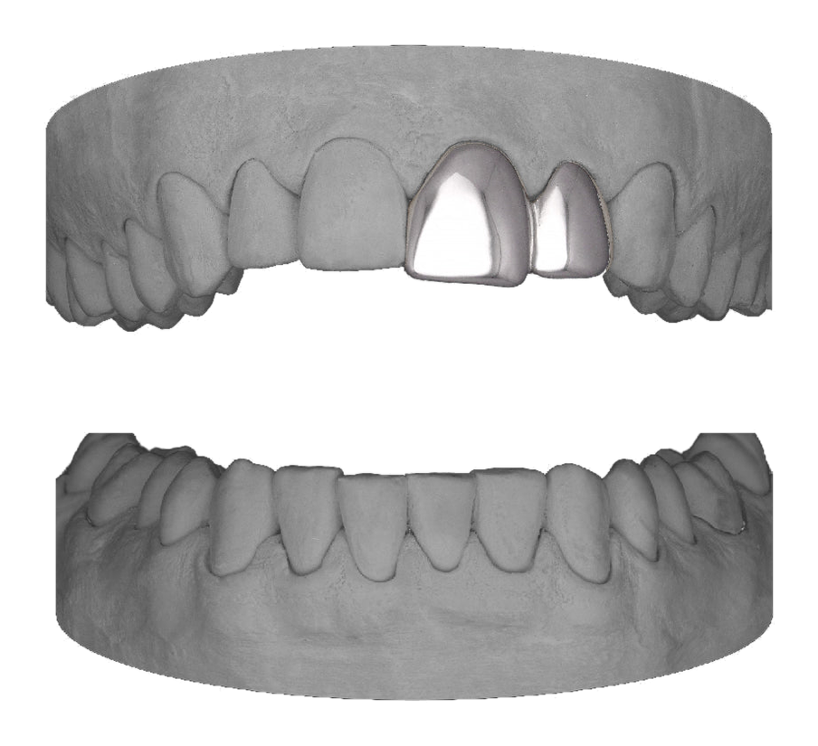 Lateral Central
