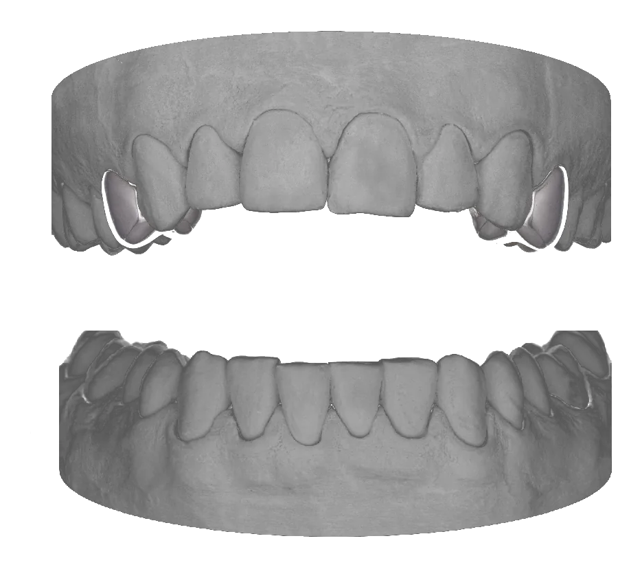 Premolar Premolar