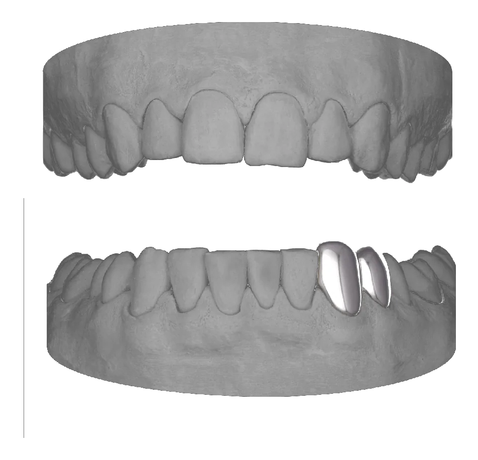 Canine Premolar 2