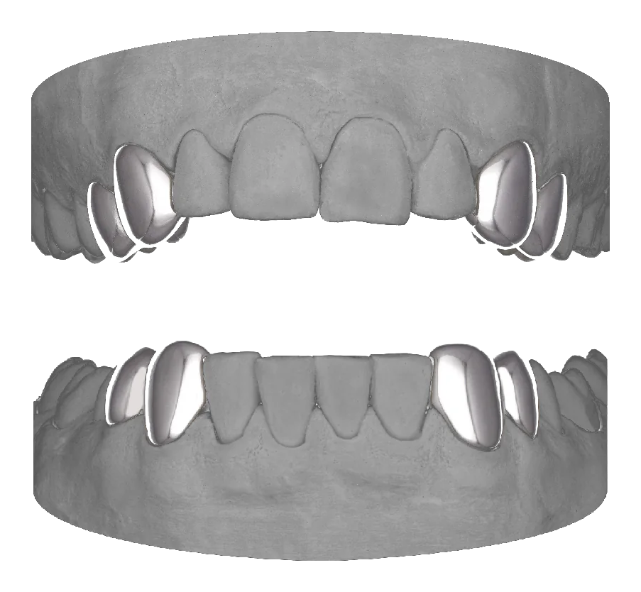 4x Canine Premolar
