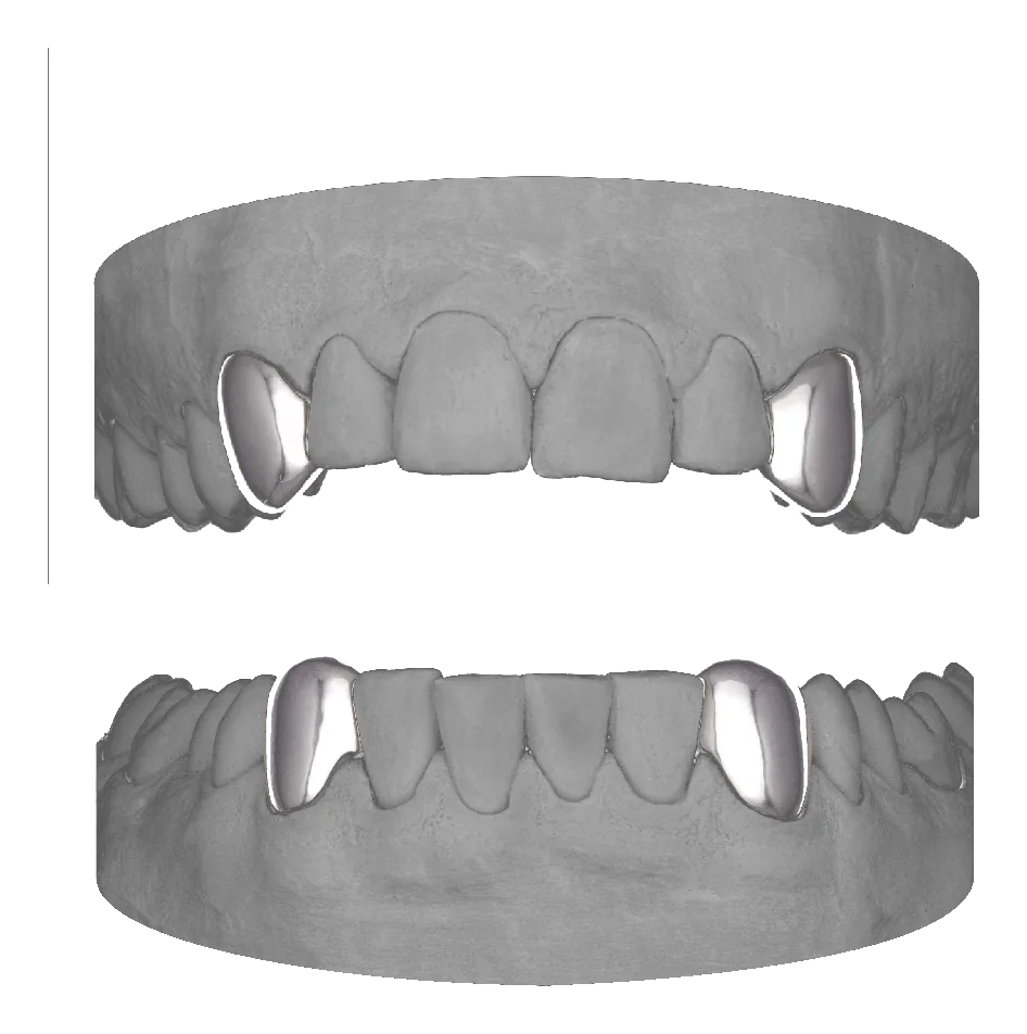 4x Canines