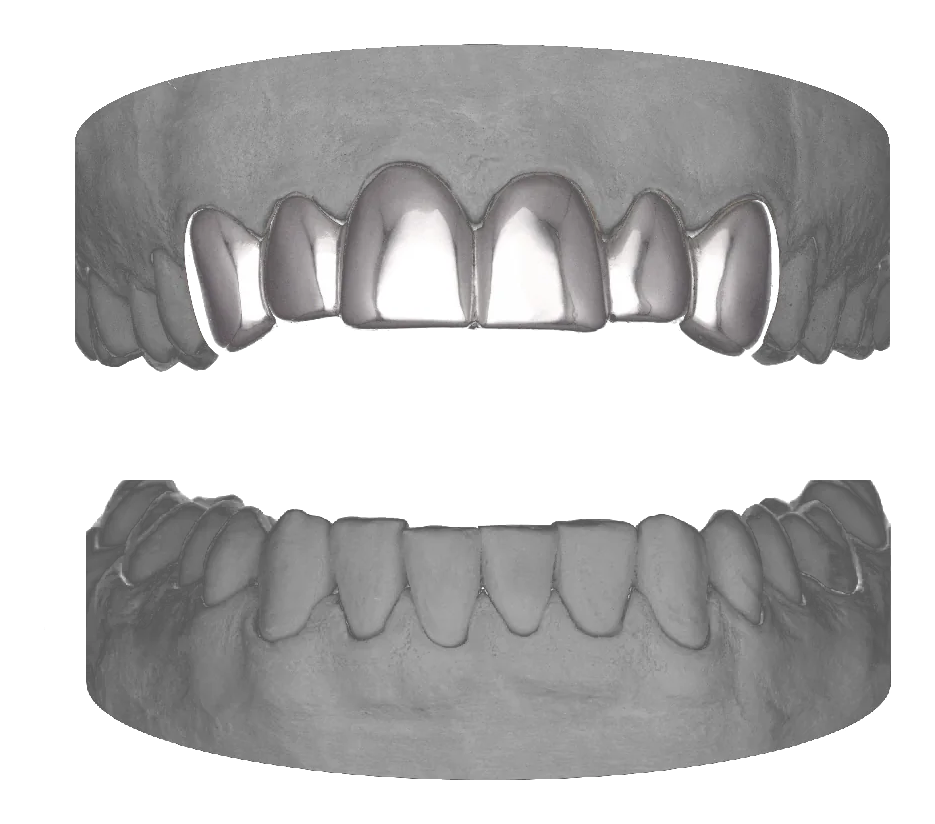 6 Set Upper