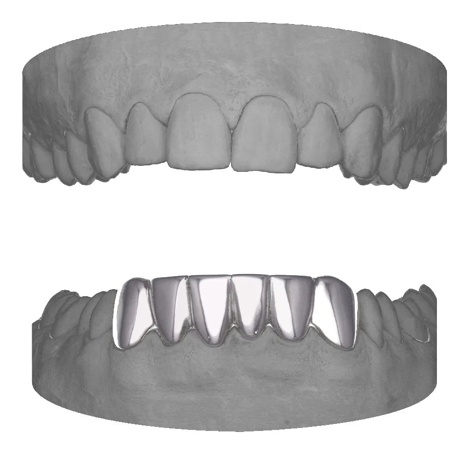 6 Set