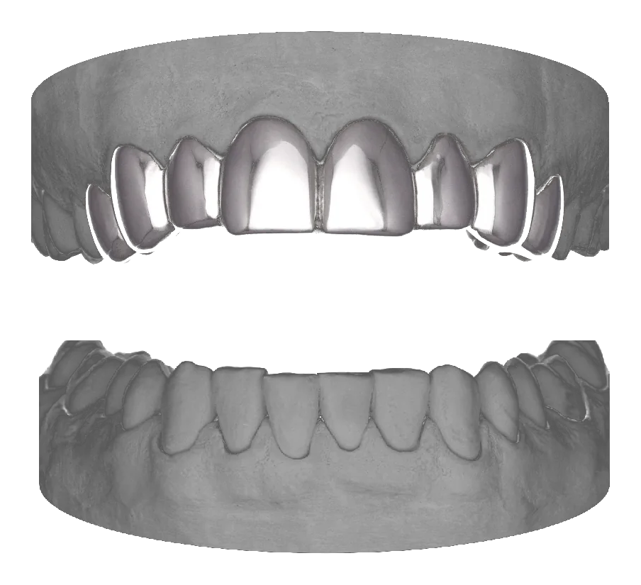 8 Set Upper