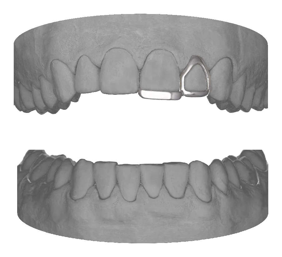 Window Lateral Bar