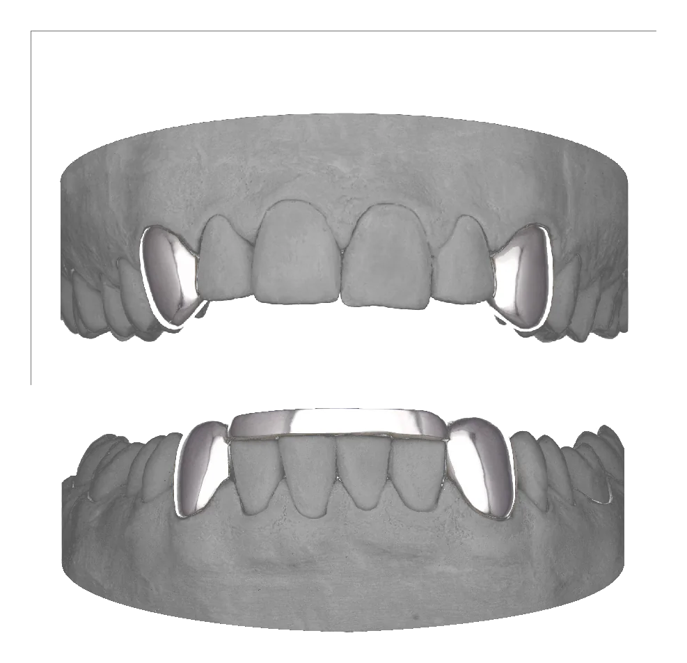 4x Canine With Bar