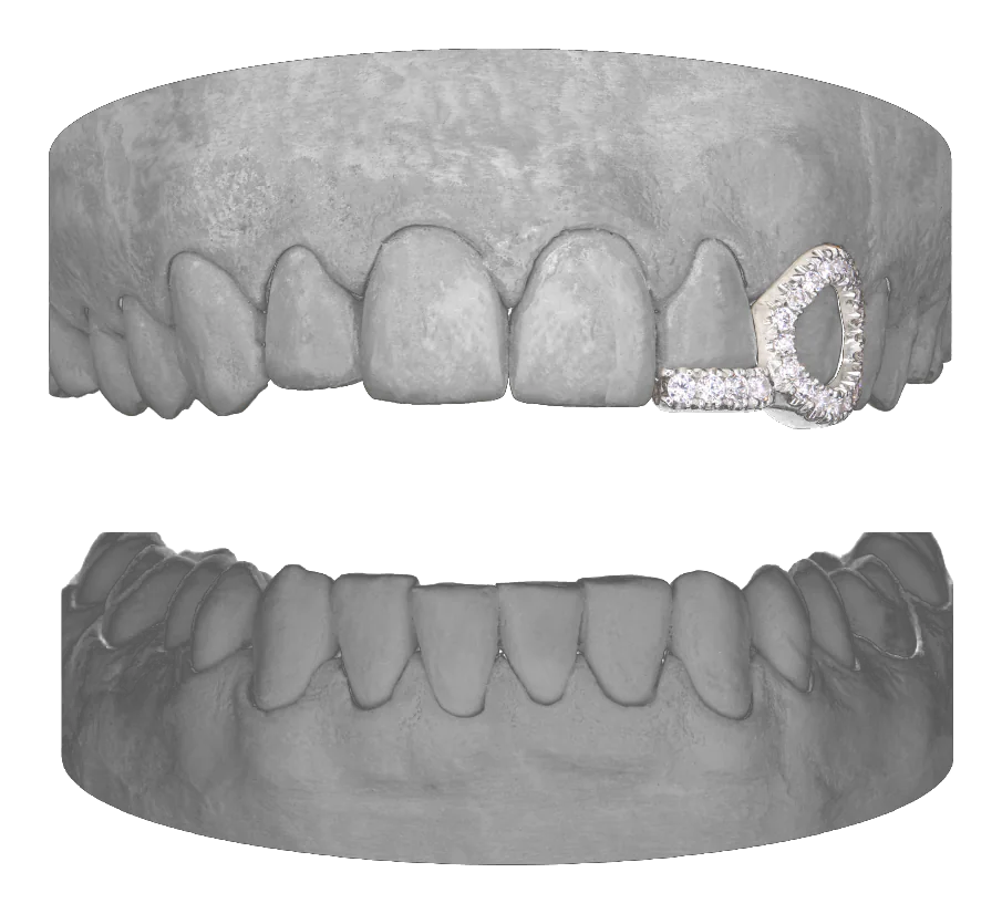 Diamond Window Canine Bar