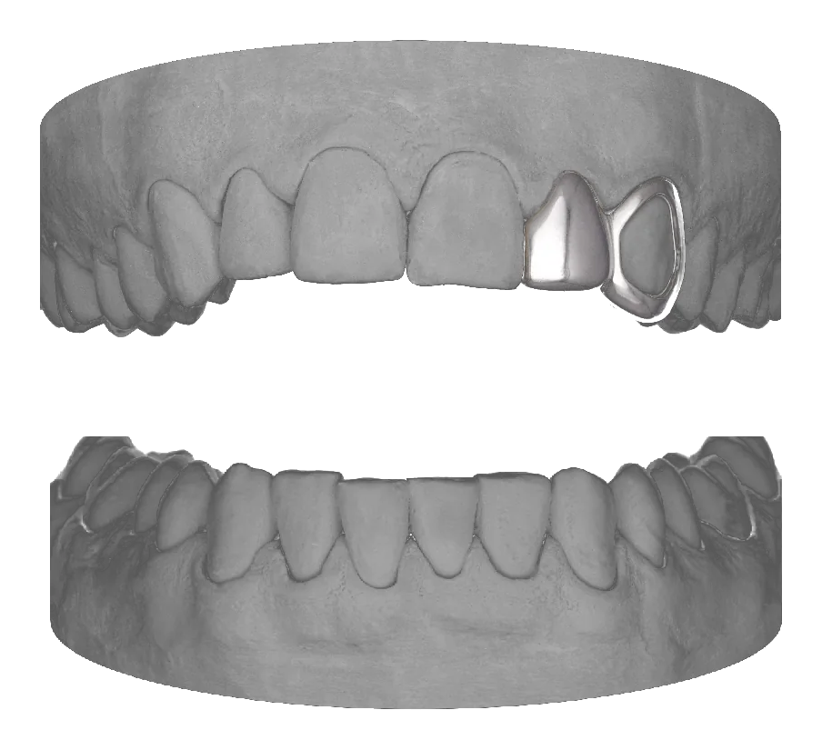 Lateral Window Canine