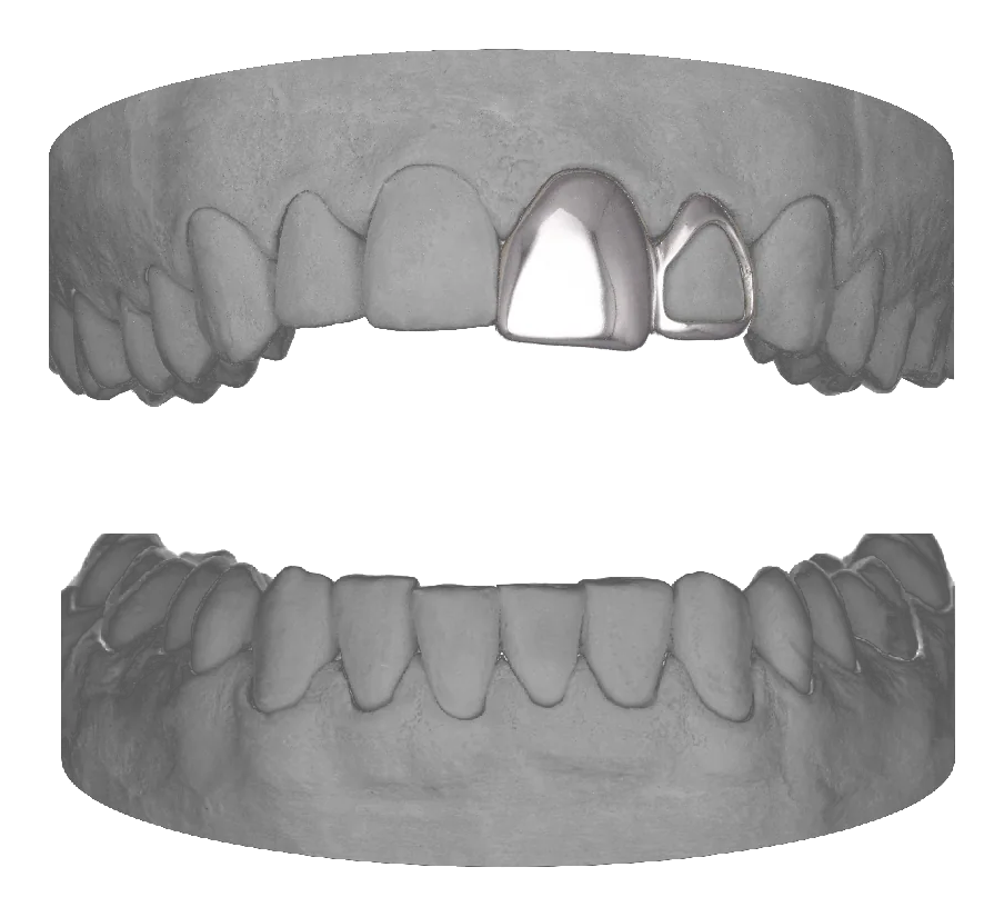 Window Lateral Central