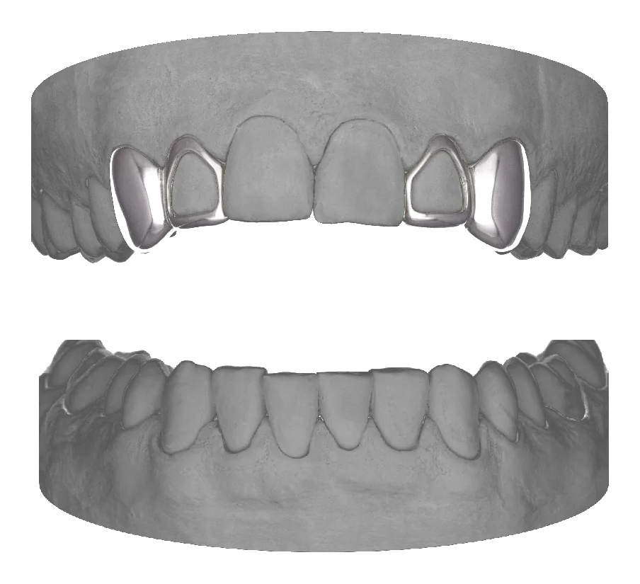 2x Window Lateral Canine