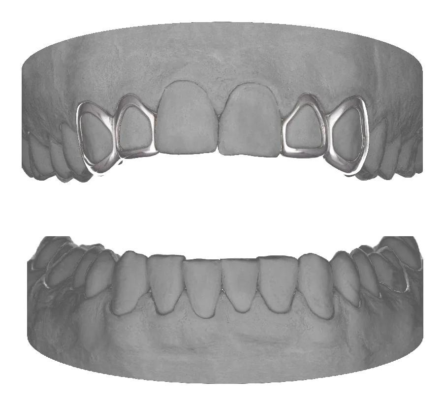 2x Window Lateral Window Canine