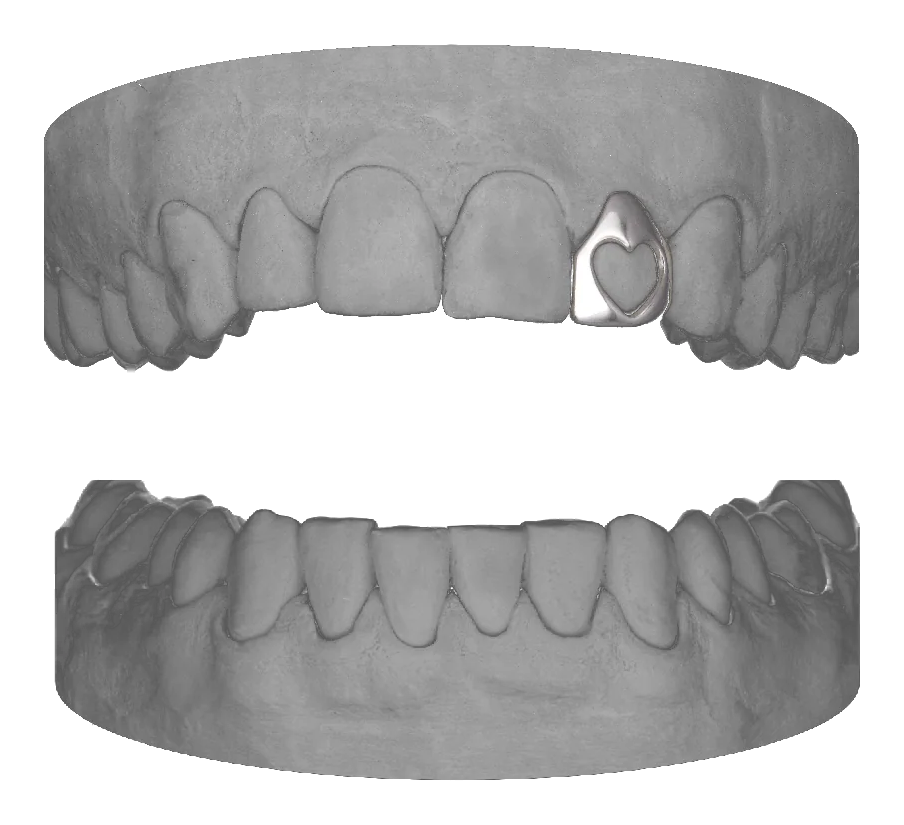 Heart Lateral