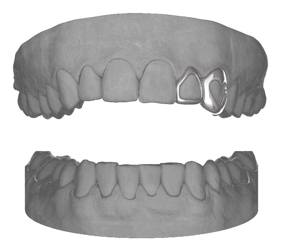 Window Lateral Heart Canine